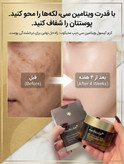 کرم کپسولی ویتامین سی مدیکیوب بمب روشن کننده و ضدلک پوست️