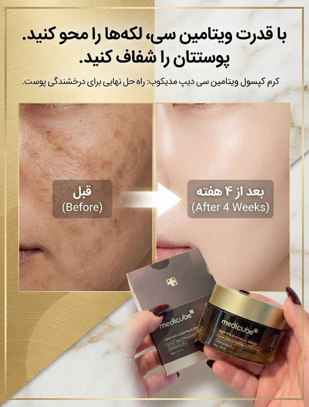 کرم کپسولی ویتامین سی مدیکیوب بمب روشن کننده و ضدلک پوست️